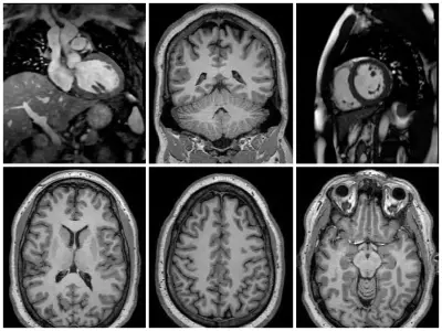 Illustration for Philips